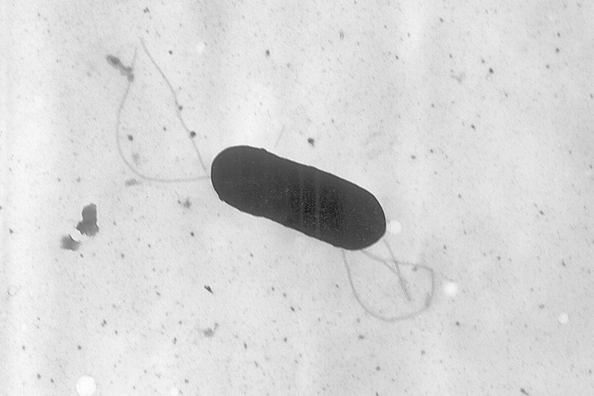 This electron microscope image made available by the Centers for Disease Control and Prevention shows a Listeria monocytogenes bacterium, responsible for the foodborne illness listeriosis. (Elizabeth White/CDC via AP)