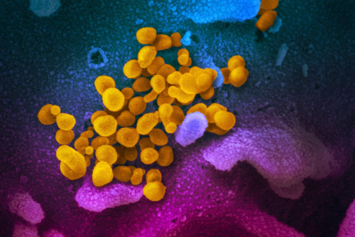 COVID-19 virus is seen in yellow, emerging from cells. (NIAID)