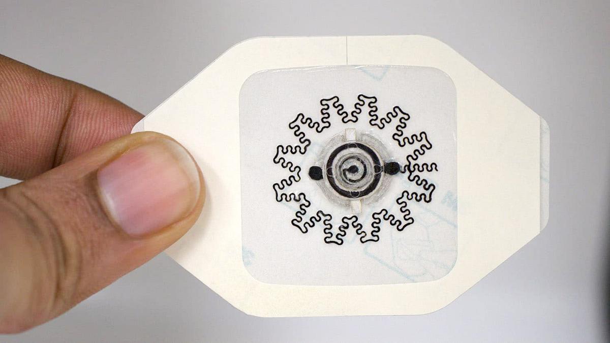 New Electric Bandage Accelerates Healing of Chronic Wounds: Animal Study