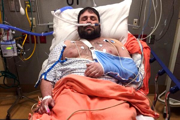Jeffery Smith rests in a hospital bed at Baystate Medical Center after crashing his snowmobile, in Springfield, Mass., on April 16, 2019. (Kerry Smith photo via AP)