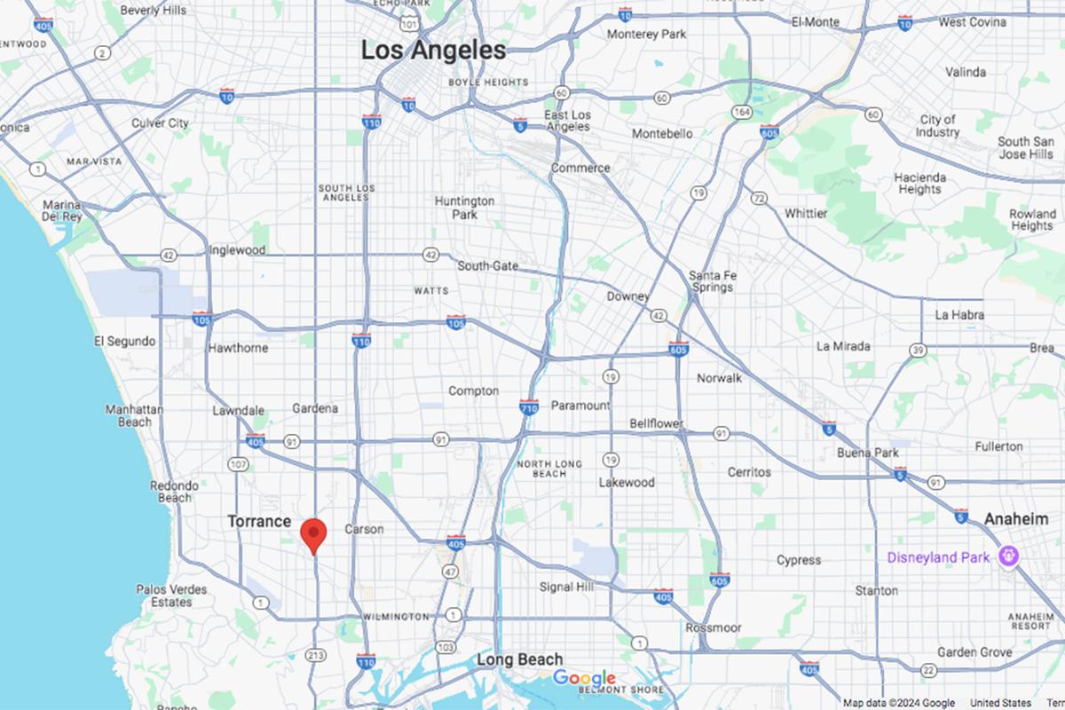 Police Say Month-Old Infant Bitten By Dog Has Died