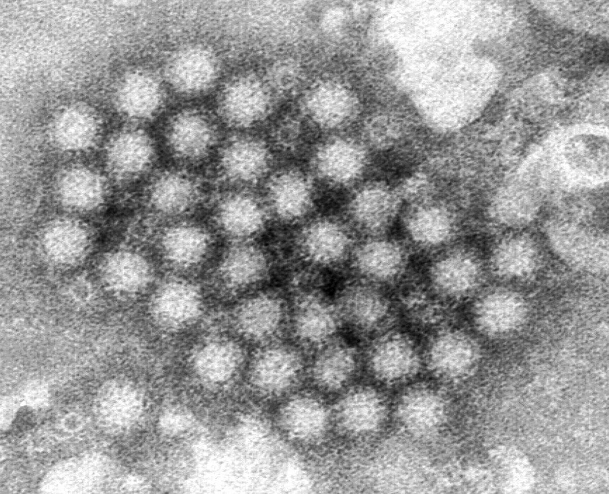 This electron microscope image provided by the Centers for Disease Control and Prevention shows a cluster of norovirus virions. (Charles D. Humphrey/CDC via AP)