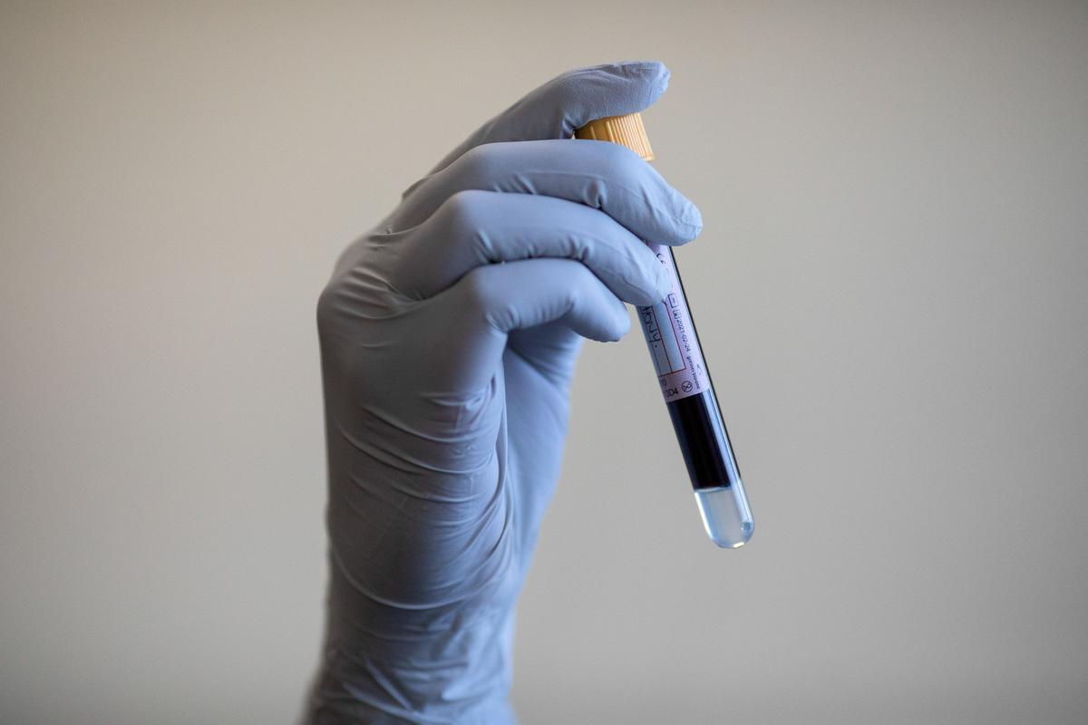 NHS to Roll Out ‘Revolutionary’ Blood Test for Lung Cancer