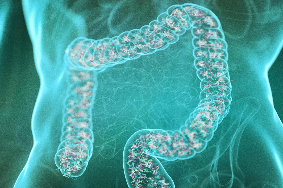 The Stress–Gut Connection: Why Anxiety Fuels Weight Gain and How to Break the Cycle