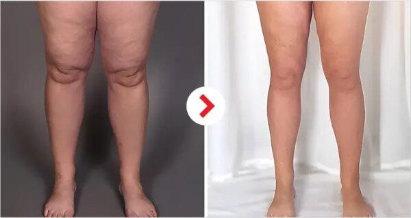 (Source: Air-C Leg Massager)