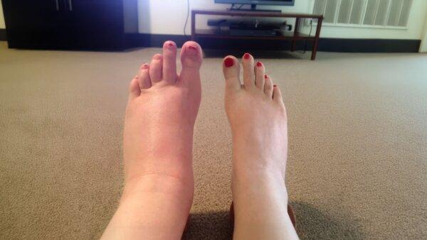 (Source: Air-C Leg Massager)