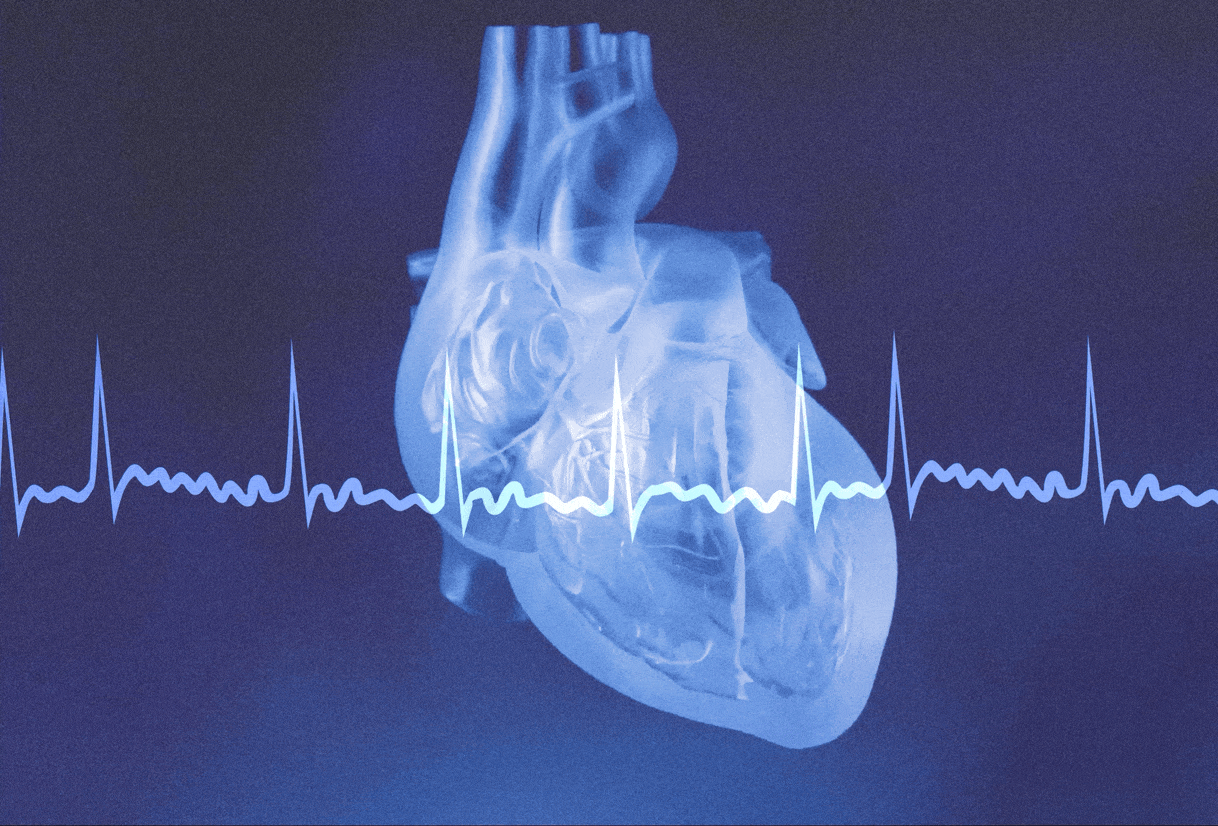 Racing Heart: Warning Sign or False Alarm? Expert Advice for Critical Situations