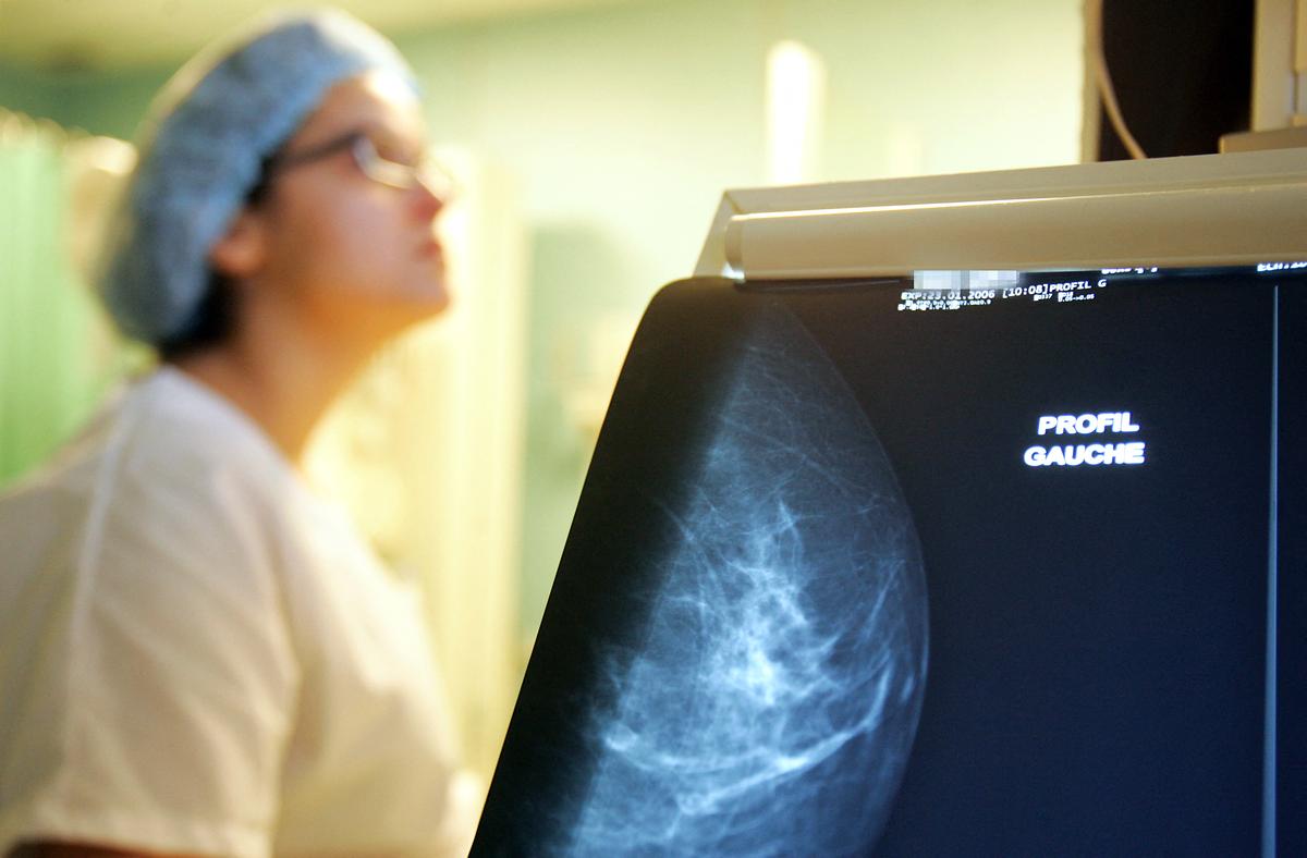 Doctor Group Updates Guidance on Breast Cancer Screening