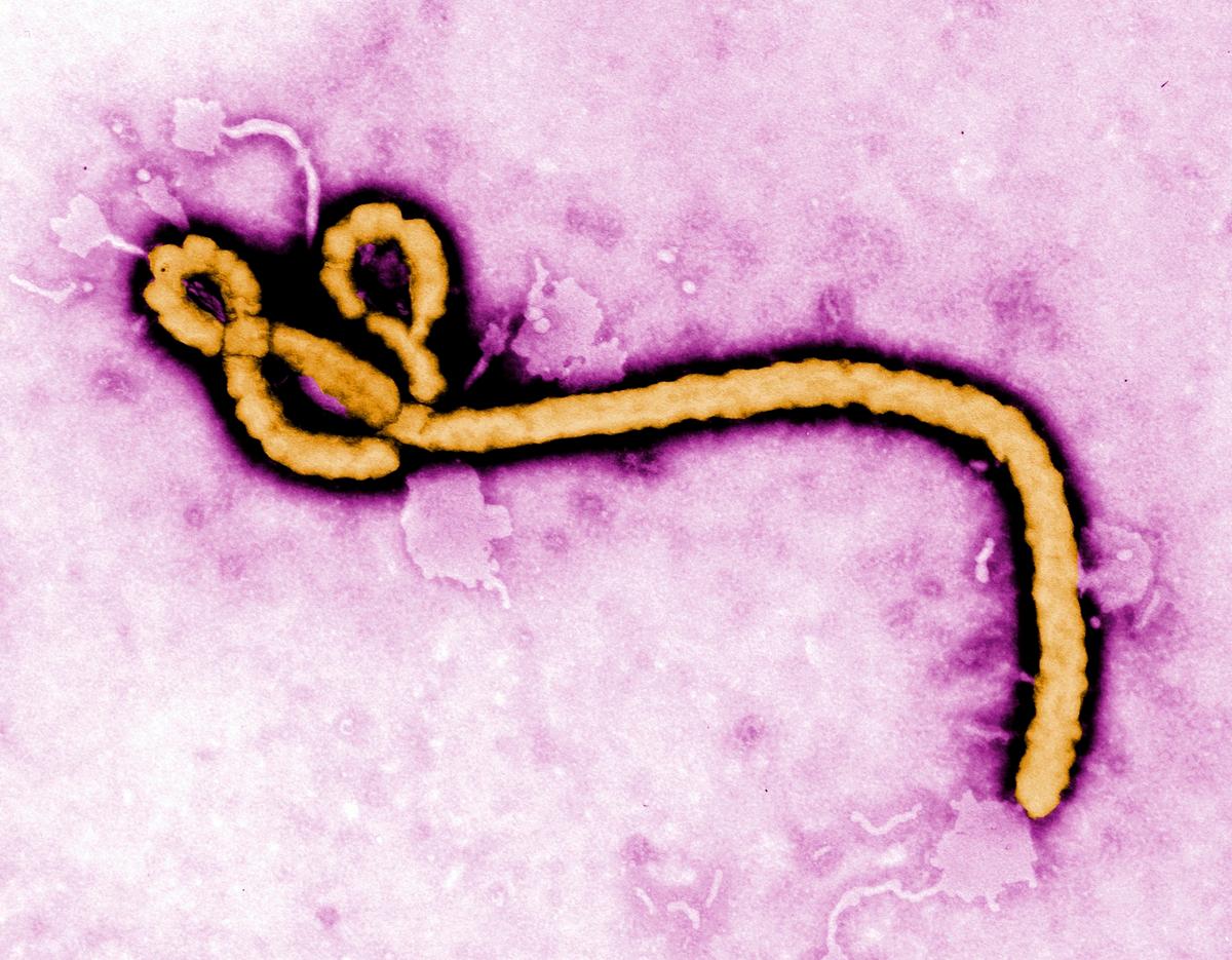 US Issues Travel Advisories Over Ebola Outbreak in Congo