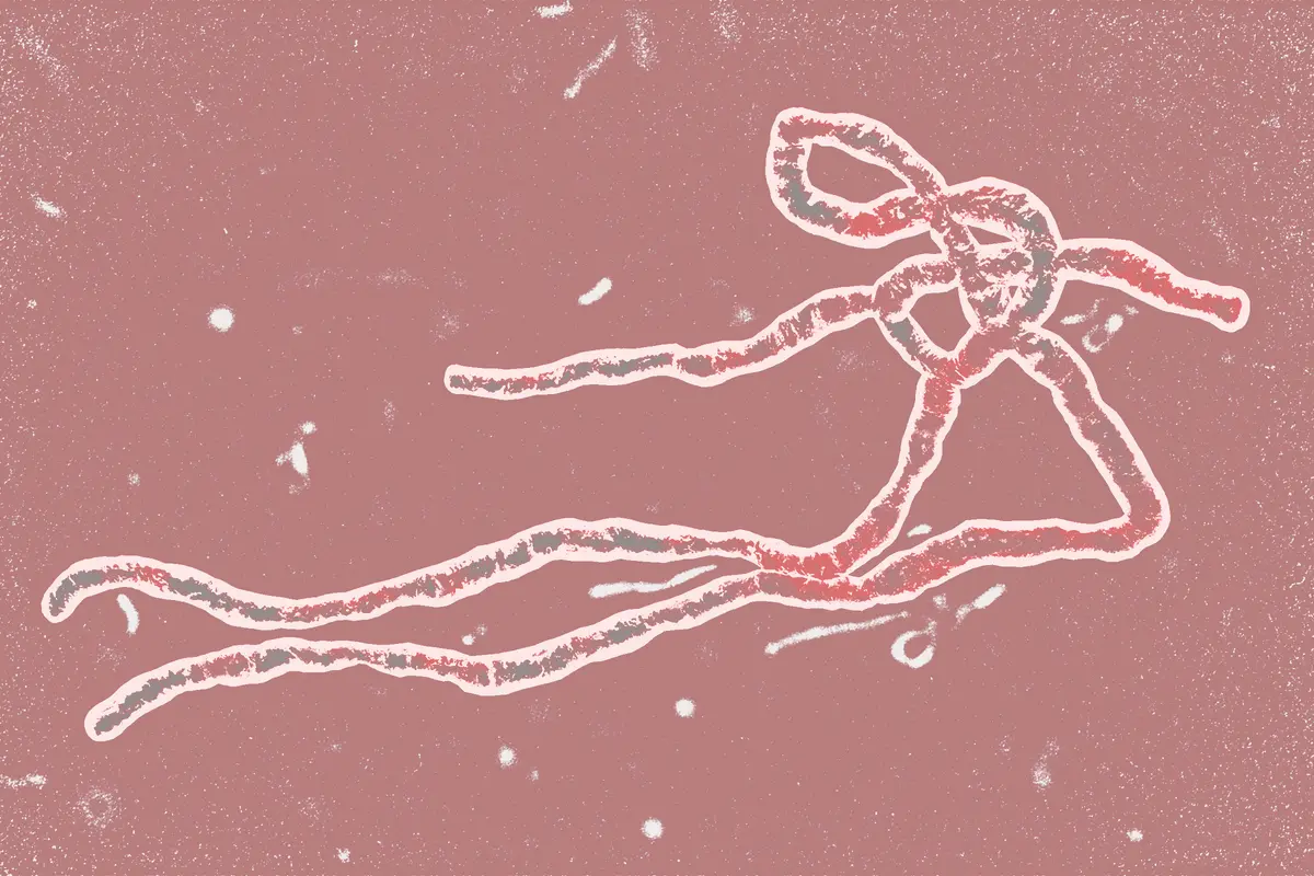 Ebola Virus Is Deadly, but Here’s Why You Don’t Need to Worry