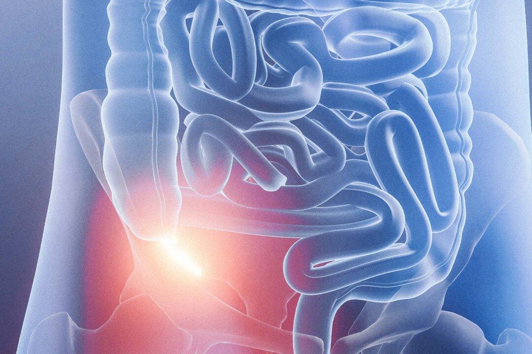 Removing the Appendix Linked to Higher Alzheimer’s Risks