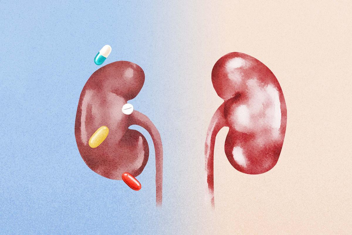 Common Supplements and Over-the-Counter Medicines That May Affect Kidneys