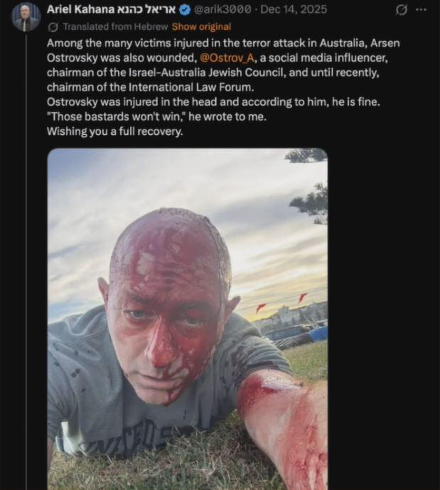 The original X post showing Arsen Ostrovsky's injures, posted to X on Dec. 14, 2025. (Courtesy of the Royal Commission into Antisemitism and Social Cohesion.)