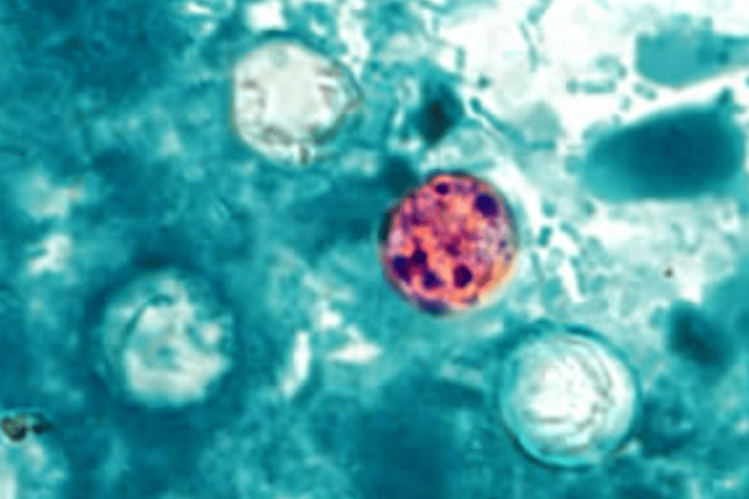 Outbreak of Diarrhea-Causing Parasite May Be Linked to Lettuce, Salad Greens: Officials