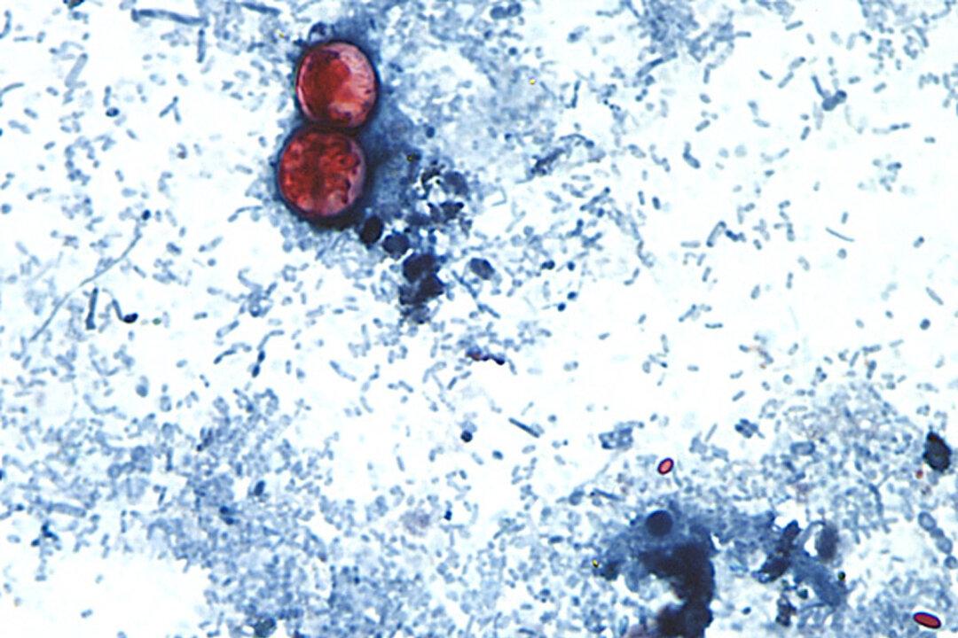 Cyclosporiasis Outbreak: Here’s the Latest Case Numbers by State