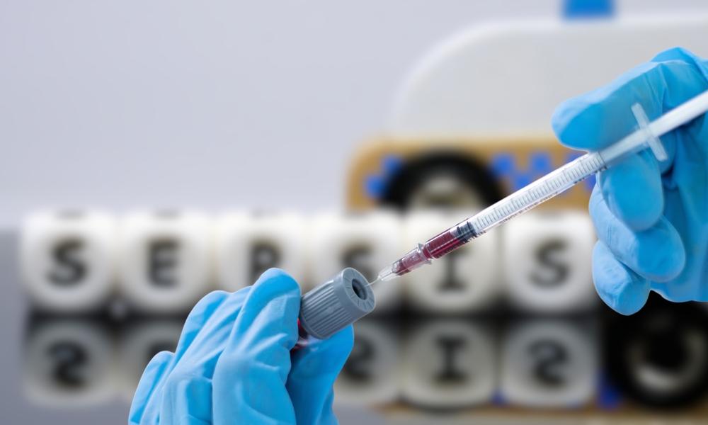 Blood sample for Sepsis, or blood poisoning PCR test. (Mihiripix/Shutterstock)