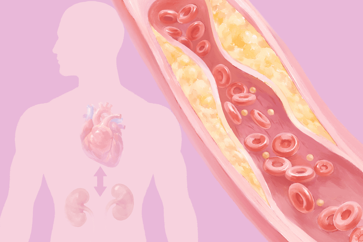 CKM Syndrome: A New Condition 9 in 10 Adults May Have–Here Are the Causes