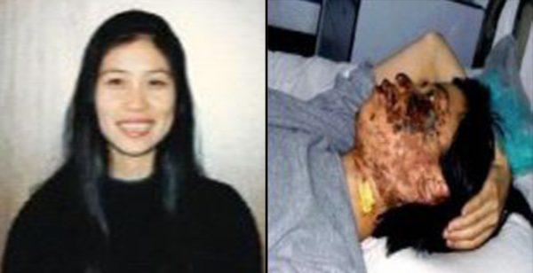 Gao Rongrong’s photo before her death. The right photo was taken 10 days after her disfiguration. (Minghui.net)