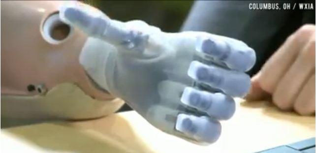 Bionic Hands: Woman Gets New $200,000 Pair of Hands (+Video)