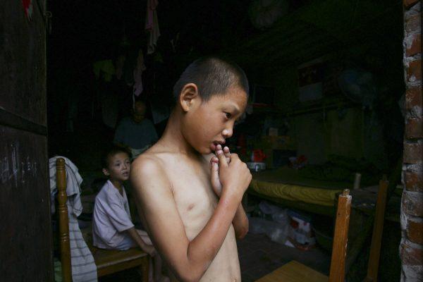 A mentally handicapped child waits to get dressed after bathing at the Wang Jiayu Orphanage that was set up by a farmer in Sanshilipu Village of Anhui Province, China. In a recent report by Human Rights Watch group, 28 percent of disabled children are not receiving the basic education they are entitled to. (China Photos/Getty Images)