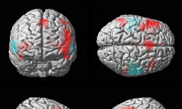 Right-Brain, Left-Brain Just a Myth, Say Neuroscientists