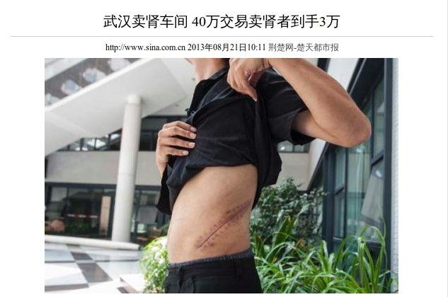 Chinese Authorities Break Up Organ Transplant Ring
