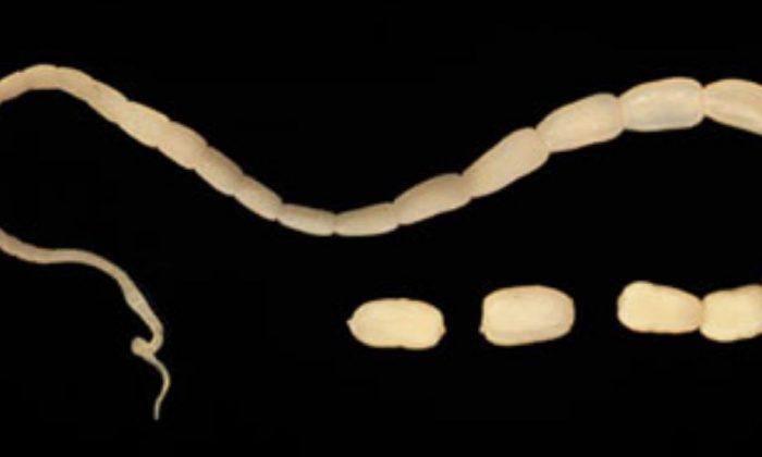 Iowa Tapeworm Diet? Woman Eats Parasite to Lose Weight