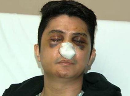 Vhong Navarro Latest News: Actor Will be ‘Incapacitated’ for a Month After Getting Beaten