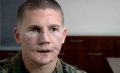 Kyle Carpenter Medal of Honor: Marine Corps Vet Was Injured in Afghanistan
