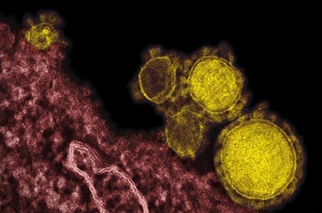 MERS Coronavirus: Treatment Options as Virus Kills First Victim in Asia and a Case Turns Up in Philippines