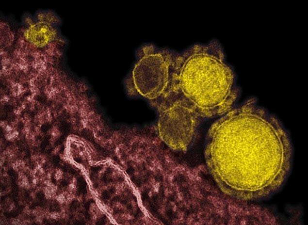 MERS Coronavirus: Treatment Options as Virus Kills First Victim in Asia and a Case Turns Up in Philippines