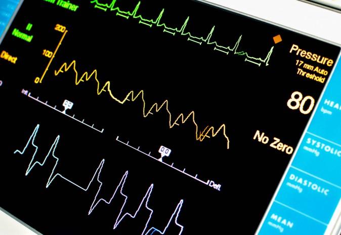 Jersey Shore University Medical Center Unveils New CardioVascular Intensive Care Unit