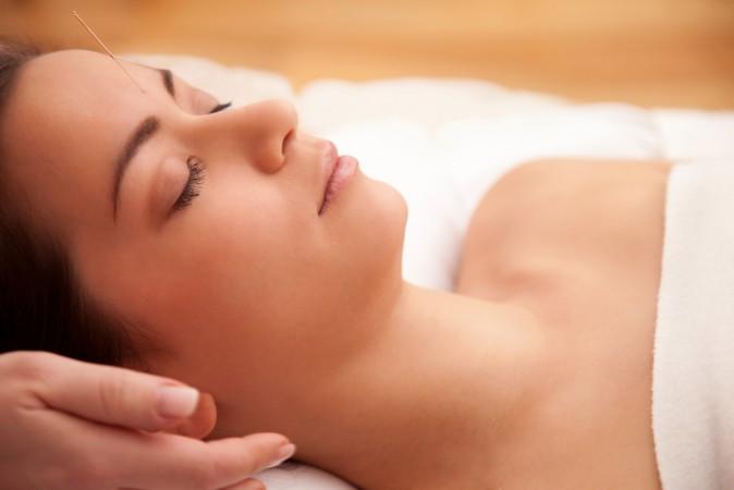 Acupuncture Helps Relieve Headache and Back Pain, Study Shows