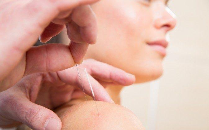 Acupuncture Placebo Sham Revealed