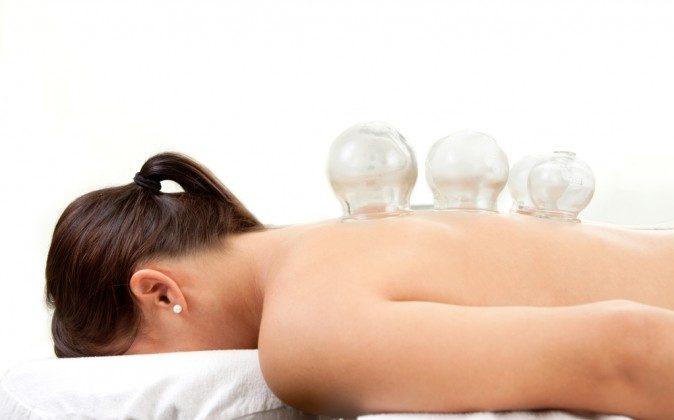 Chinese Medicine Basics; Acupuncture, Cupping, Moxabustion and Herbal Medicine