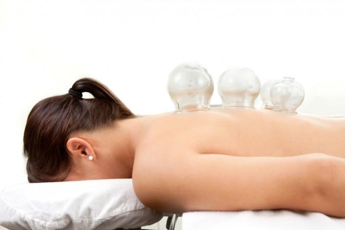 Chinese Medicine Basics; Acupuncture, Cupping, Moxabustion and Herbal Medicine