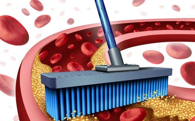 7 Simple Ways to Unclog Your Arteries Naturally (Video)