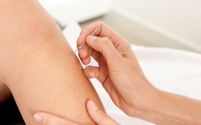 Acupuncture Lowers Blood Pressure 