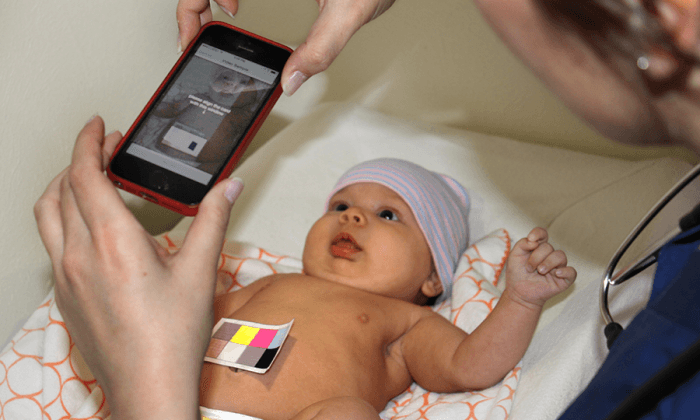 New Smartphone App Can Detect Newborn Jaundice in Minutes 