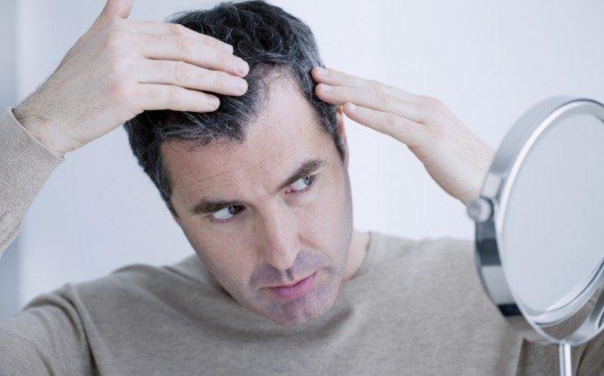 Stop Hair Loss With These Natural Remedies