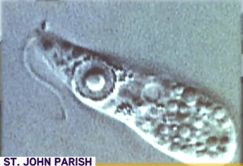 Killer Amoeba Found in Louisiana Water System (Video)