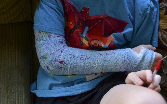 Why a Broken Arm Can Take Forever to Heal