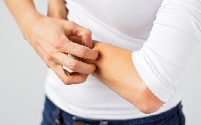 Why Scratching Makes You Itch More