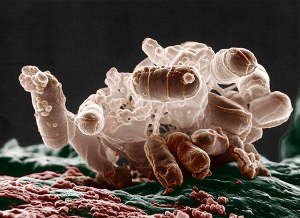 We each have around 1.5kg of bacteria in our guts. (Getty Images, Christopher Pooley, CC BY)