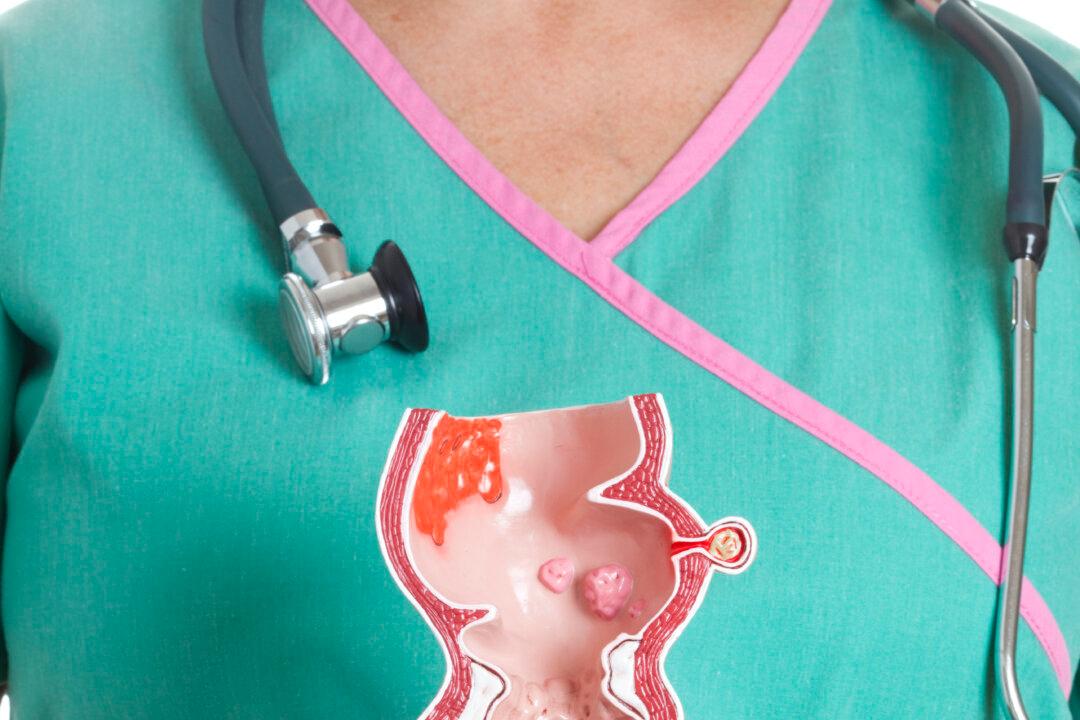 Why It’s Smart to Test for Colon Cancer