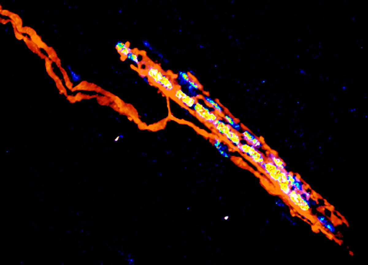 Trigger Mechanism for Recovery After Spinal Cord Injury Revealed