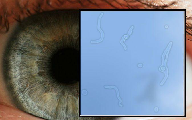The Eye Floater Phenomenon: Between Science and Spirituality
