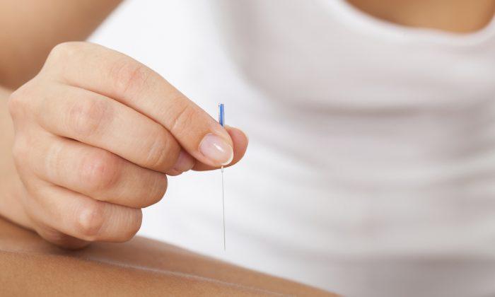 Acupuncture Point Sensitivity Linked to Menstrual Pain