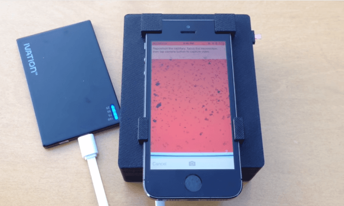 Smartphones Can Now Detect Parasites in Your Blood