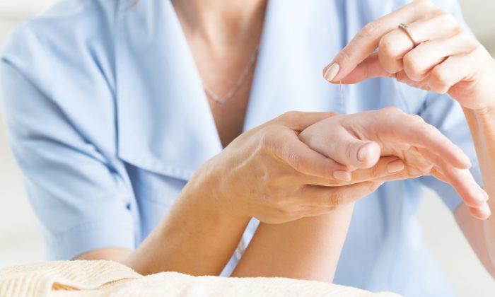Acupuncture Can Reduce Side Effects of Breast Cancer Treatment